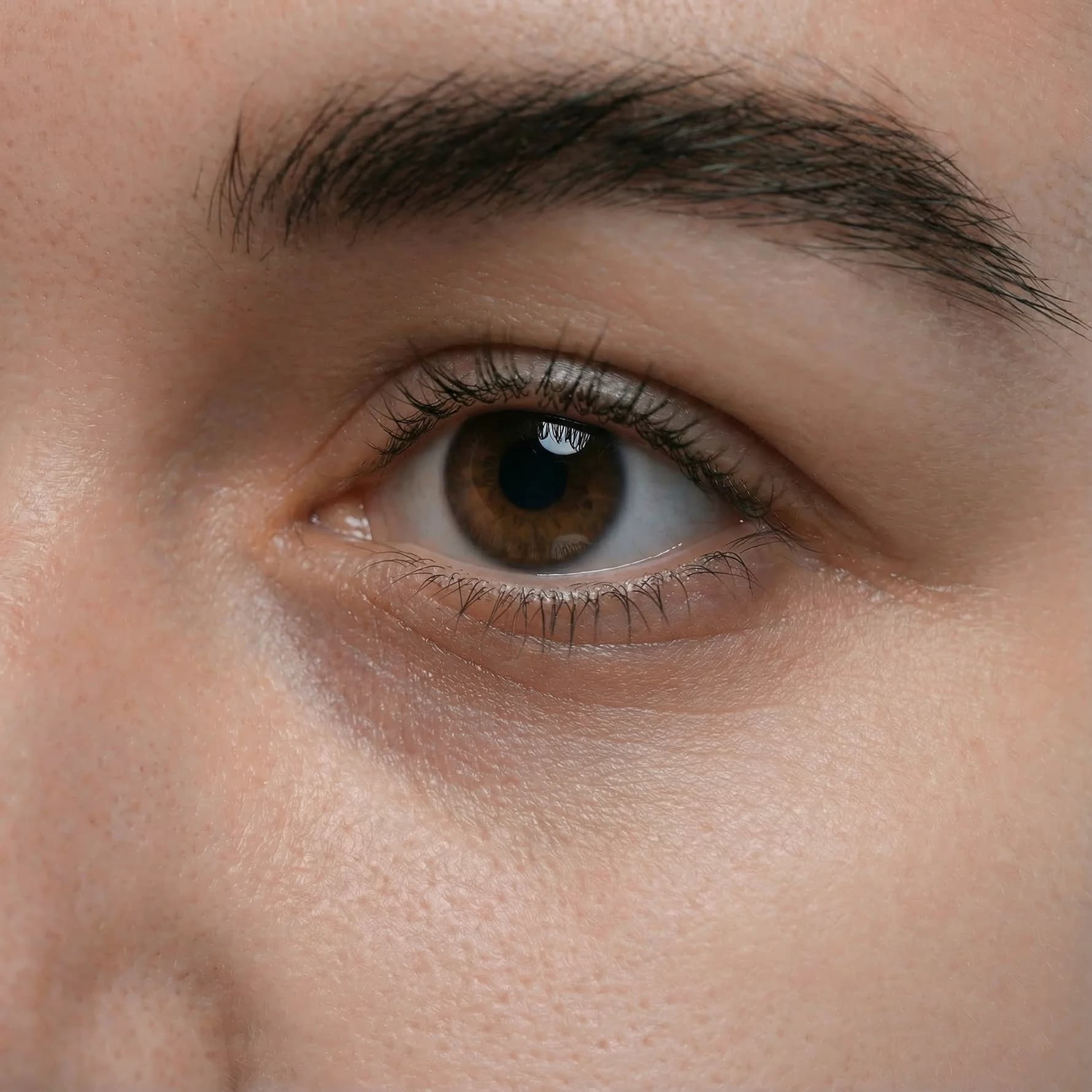Under-eye area before using Sage Renewal patches
